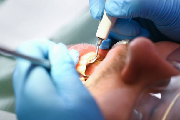 Best Emergency TMJ Treatment in Tazewell, VA