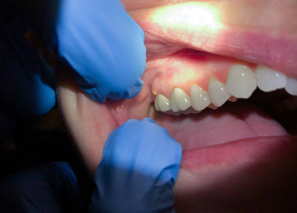Best Weekend Emergency Dentist in Tazewell, VA