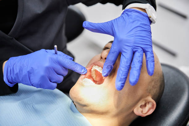 Best Emergency Dental Care for Broken or Chipped Teeth in Tazewell, VA