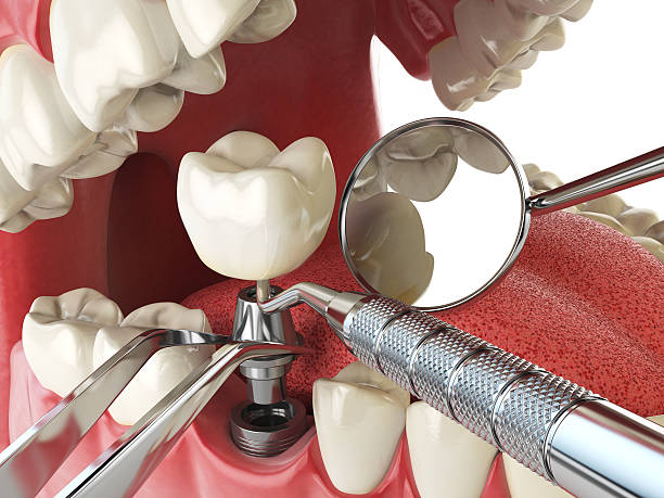 Best Urgent Care for Lost Fillings or Crowns in Tazewell, VA